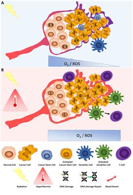 Hyperthermia and radiotherapy: physiological basis for a synergistic effect